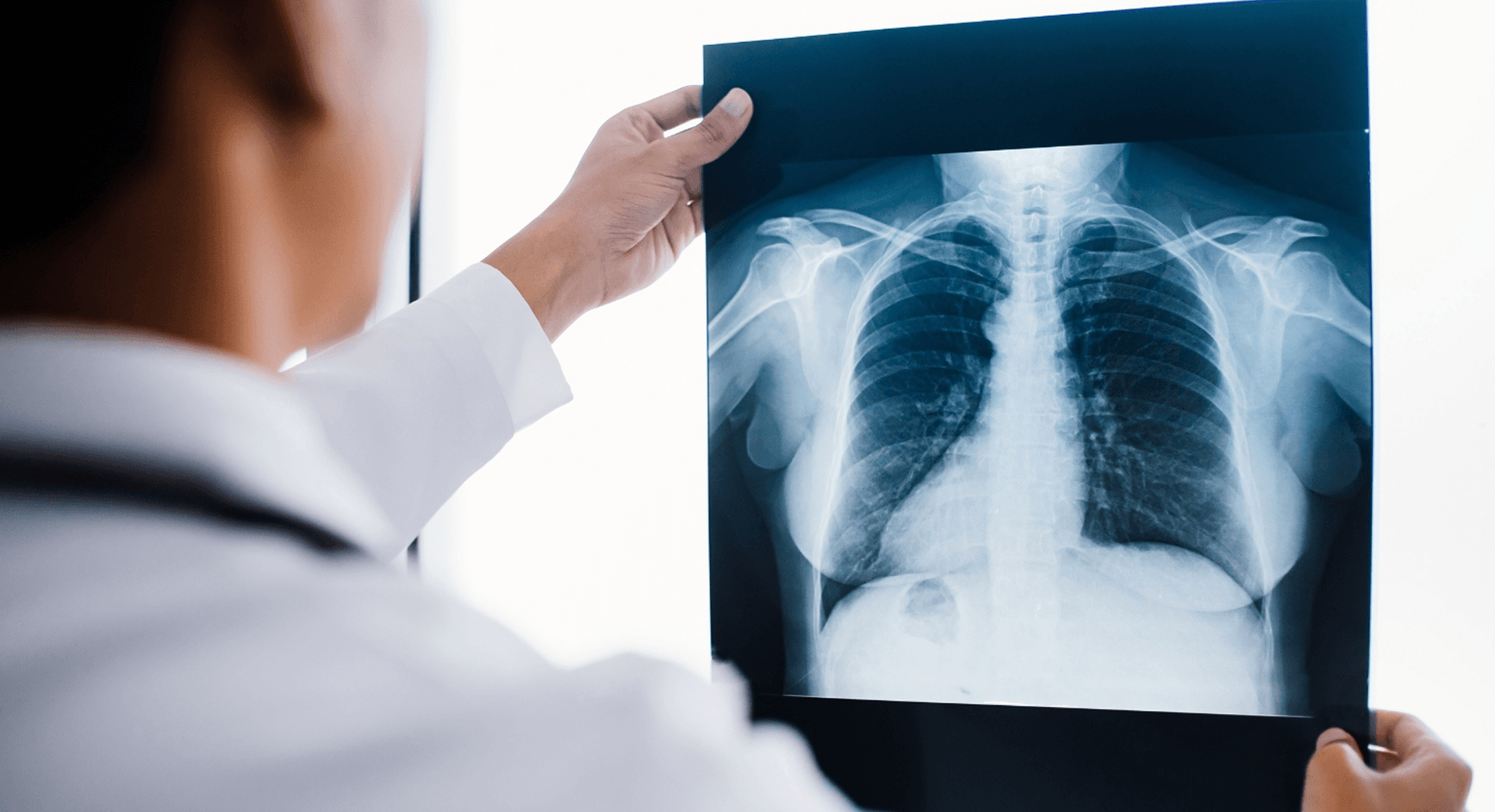 Clinician reviewing a chest x-ray.